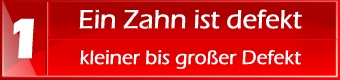 Ein Zahn ist defekt